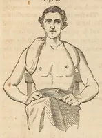 An illustration from The American journal of the medical sciences (1827)