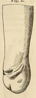 An illustration from The American journal of the medical sciences (1827)