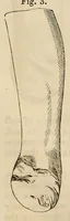 An illustration from The American journal of the medical sciences (1827)
