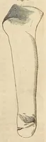 An illustration from The American journal of the medical sciences (1827)