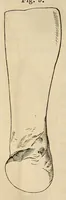 An illustration from The American journal of the medical sciences (1827)