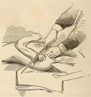 Picture 3 of 8 from The American journal of the medical sciences (1827), leaf 306