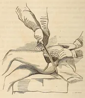 An illustration from The American journal of the medical sciences (1827)