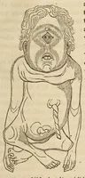 An illustration from The American journal of the medical sciences (1827)