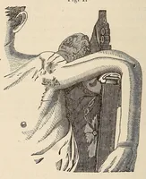 An illustration from The American journal of the medical sciences (1827)