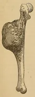 An illustration from The American journal of the medical sciences (1827)