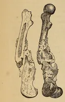 An illustration from The American journal of the medical sciences (1827)
