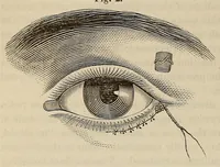 An illustration from The American journal of the medical sciences (1827)