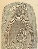 An illustration from The American journal of the medical sciences (1827)