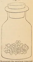 Picture 8 of 17 from The American journal of the medical sciences (1827), leaf 147