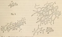 An illustration from The American journal of the medical sciences (1827)