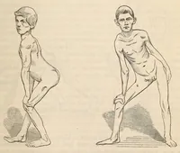 An illustration from The American journal of the medical sciences (1827)