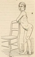 An illustration from The American journal of the medical sciences (1827)