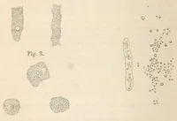 An illustration from The American journal of the medical sciences (1827)