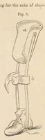 An illustration from The American journal of the medical sciences (1827)