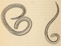 An illustration from The American journal of the medical sciences (1827)