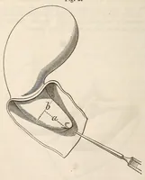 An illustration from The American journal of the medical sciences (1827)