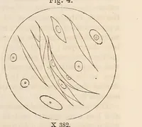 Picture 8 of 16 from The American journal of the medical sciences (1827), leaf 127
