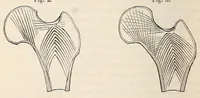 An illustration from The American journal of the medical sciences (1827)