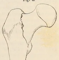 Picture 13 of 16 from The American journal of the medical sciences (1827), leaf 383