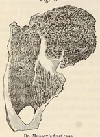 Picture 14 of 16 from The American journal of the medical sciences (1827), leaf 388