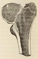 Picture 15 of 16 from The American journal of the medical sciences (1827), leaf 388