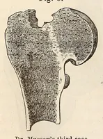 An illustration from The American journal of the medical sciences (1827)