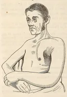 An illustration from The American journal of the medical sciences (1827)