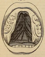 An illustration from The American journal of the medical sciences (1827)