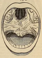 An illustration from The American journal of the medical sciences (1827)