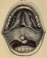 An illustration from The American journal of the medical sciences (1827)