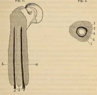 An illustration from The American journal of the medical sciences (1827)