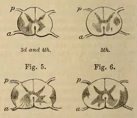 An illustration from The American journal of the medical sciences (1827)