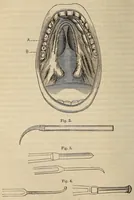 An illustration from The American journal of the medical sciences (1827)