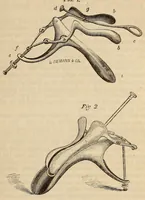 An illustration from The American journal of the medical sciences (1827)