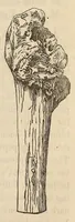An illustration from The American journal of the medical sciences (1827)