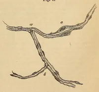 Picture 11 of 17 from The American journal of the medical sciences (1827), leaf 393