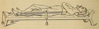 Picture 13 of 17 from The American journal of the medical sciences (1827), leaf 398