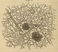 Picture 3 of 17 from The American journal of the medical sciences (1827), leaf 114