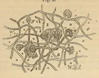 Picture 4 of 17 from The American journal of the medical sciences (1827), leaf 115