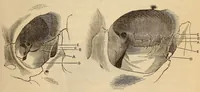 An illustration from The American journal of the medical sciences (1827)