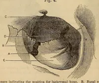 Picture 6 of 17 from The American journal of the medical sciences (1827), leaf 122