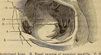 Picture 7 of 17 from The American journal of the medical sciences (1827), leaf 122