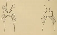 An illustration from The American journal of the medical sciences (1827)