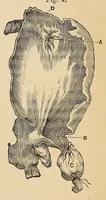 Picture 15 of 17 from The American journal of the medical sciences (1827), leaf 369