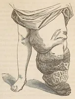 Picture 8 of 14 from The American journal of the medical sciences (1827), leaf 123