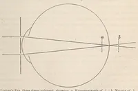 Picture 12 of 14 from The American journal of the medical sciences (1827), leaf 413
