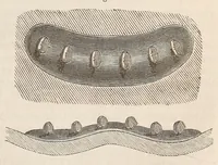 An illustration from The American journal of the medical sciences (1827)