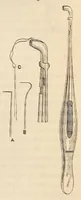 An illustration from The American journal of the medical sciences (1827)