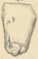 An illustration from The American journal of the medical sciences (1827)